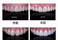 点击看大图 -慕拉美甲美睫皮肤管理