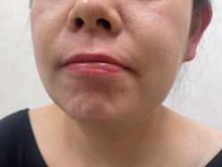 -长沙雅美医疗美容医院