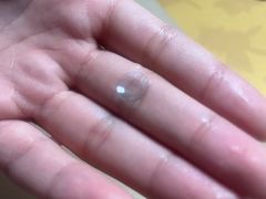 -天津大学爱尔眼科医院(天津院区)