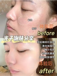 -恒妍医美·韩国定制抗衰中心