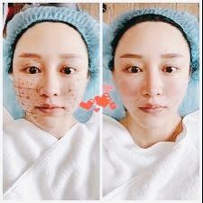 -SKINIST丽铂医疗美容