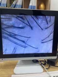 -岳灵生发养发馆