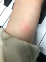 -More摩尔医美の注射线雕光电中心