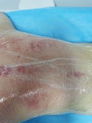 -清媚减肥瘦身纤体