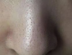 -正璞医疗美容·皮肤修复·微整注射