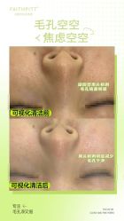 -凡碧诗毛孔清洁收细