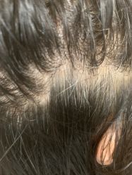 -诗碧曼养发