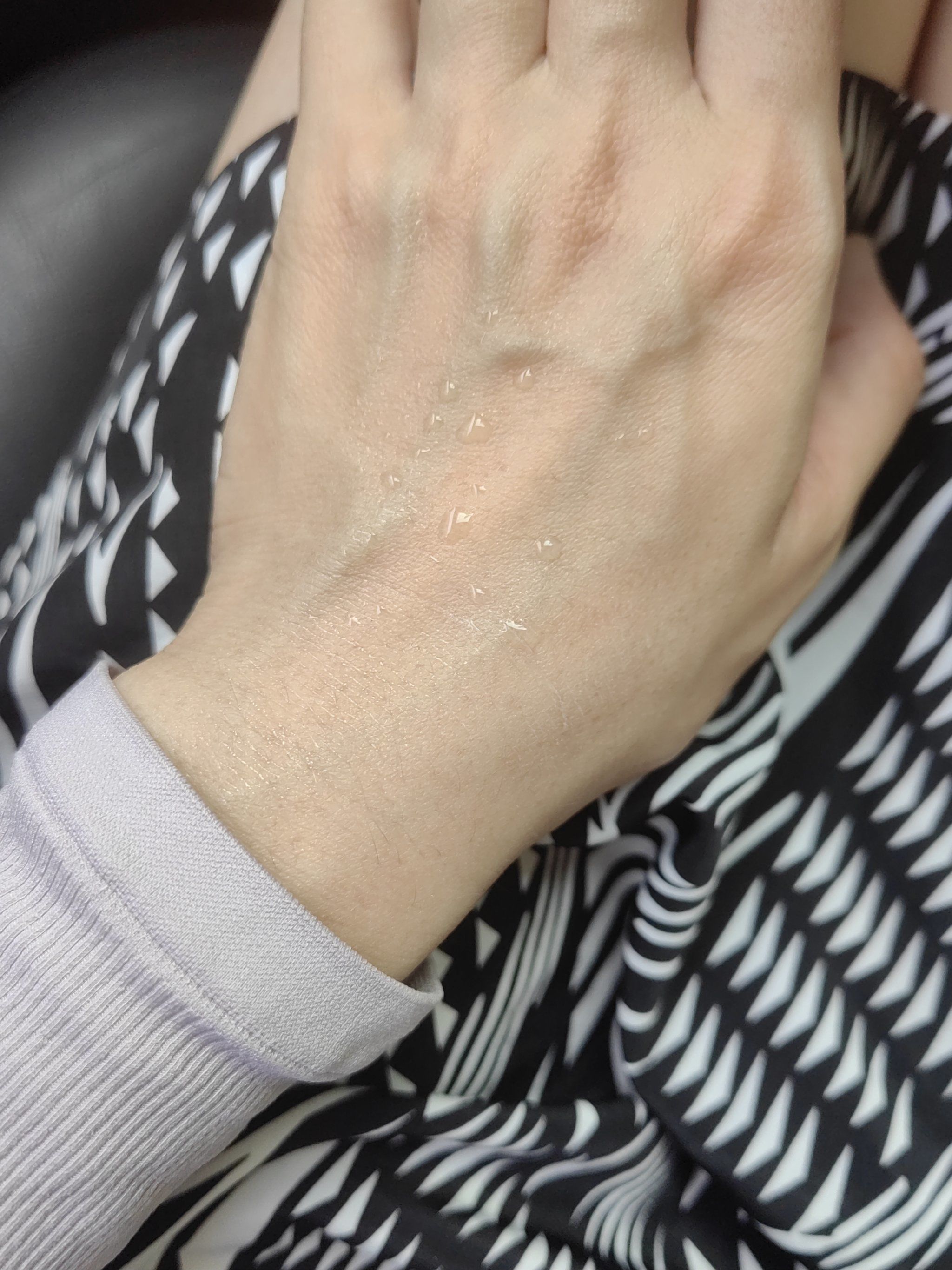 手为什么会出汗