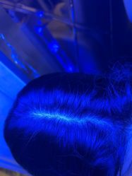 -碧莲盛·不剃发植发