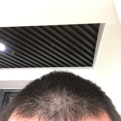 点击看大图 -AD HAIR