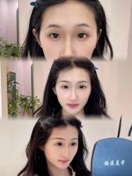 -杨益美学·野生眉半永久纹眉发际线