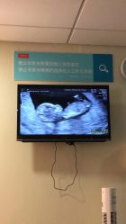 -杭州贝瑞斯美华妇儿医院·早孕·产检·儿科