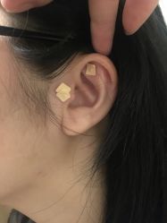 -肥三针腧穴瘦身馆