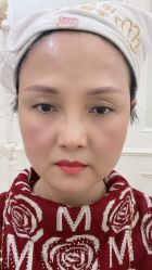 体验后-禾丽康美医疗美容医院