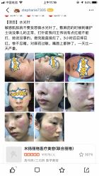 -北京米扬丽格医疗美容·联合丽格鼻整形中心