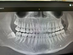 -牙博士口腔品牌连锁(杨浦店)