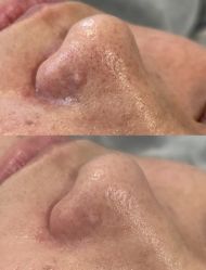 -SKIN79皮肤管理中心