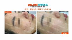 -痘敏医生专业祛痘·肌肤修复连锁