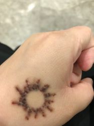 -英刺青 纹身 洗纹身
