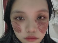 -重庆医科大学附属第一医院(本部)