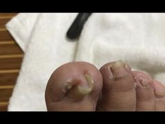 -世龙世家甲沟炎·灰指甲·嵌甲矫正·修脚(武侯区双楠店)