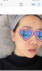 体验后-MIACHIC蜜雅琦珂·美肌