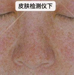 点击看大图 -睿明真达专业皮肤护理中心