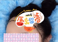 -大麦微针植发全国连锁