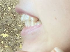 -极光口腔·矫正种植修复(锦江店)