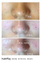 光SPA水氧+op t-光SPA科技美肤