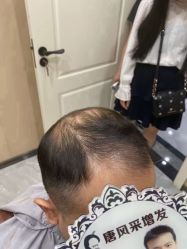 -唐风采假发补发定制