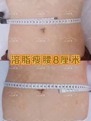 -Lily纤美·科技减脂中心