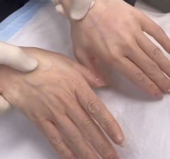 -杭州米兰柏羽医疗美容医院