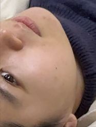 -长沙雅美医疗美容医院