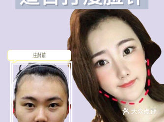 咬紧后槽牙发现有明显鼓出来一块很发达的肌肉的人