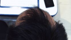 -雍禾植发全国连锁