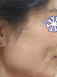 体验后-青岛诺德医学美容医院