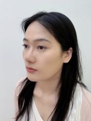 体验后-Yestar艺星医疗美容医院