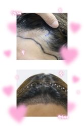 -熙朵美学植发·连锁品牌