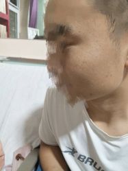 -北京美痣堂古方祛痣斑疣瘊
