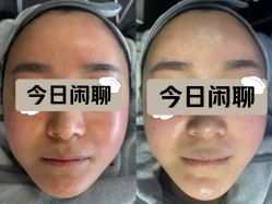 点击看大图 -SKIN79皮肤管理中心