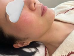 体验后-BR光电保养