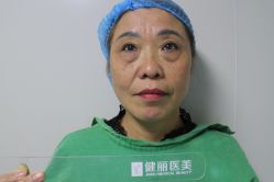 -天津健丽·去眼袋医疗美容机构