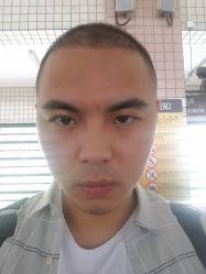 点击看大图 -大麦微针植发丨全国连锁