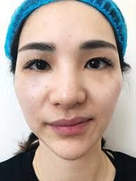 -SKINIST丽铂医疗美容