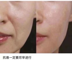 -LUNA皮相美·骨相美高级美感