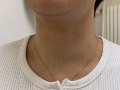 体验后-联合丽格·张菡丽格医疗美容