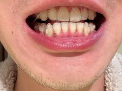 -齐玉齿科JADENTAL