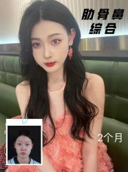 -北京米扬丽格医疗美容·联合丽格鼻整形中心
