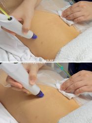 点击看大图 -韩国淼美颜皮肤管理官方直营店